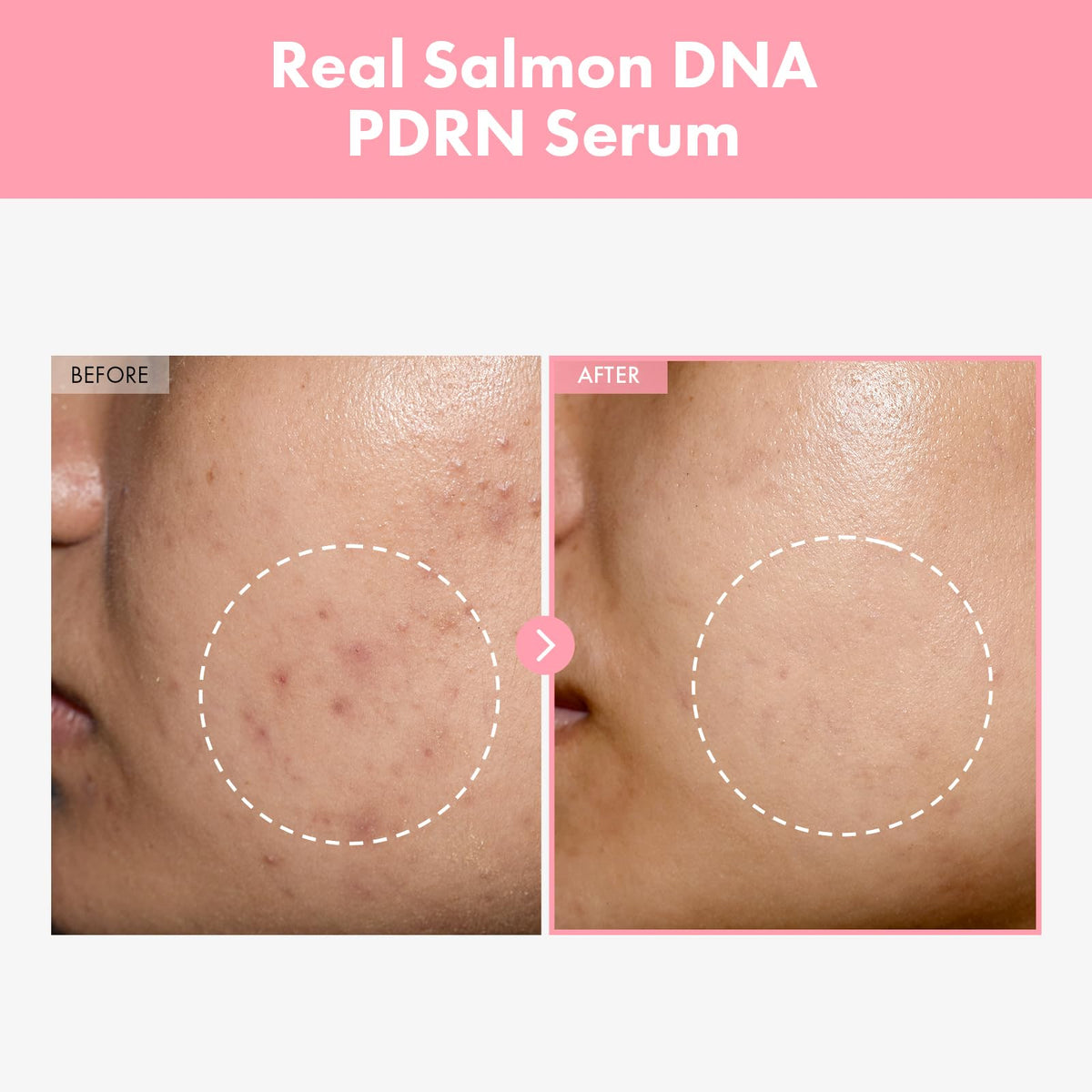TOSOWOONG close-up of serum texture droplet, demonstrates lightweight hydrating absorption benefit