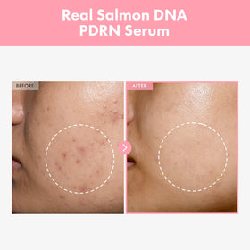 TOSOWOONG close-up of serum texture droplet, demonstrates lightweight hydrating absorption benefit