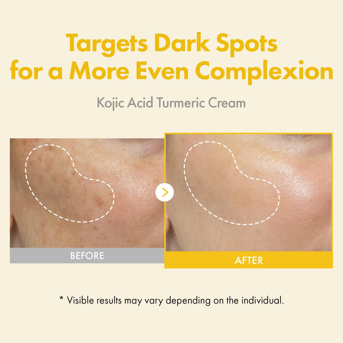 TOSOWOONG cream texture close-up showing smooth spreadability and hydration