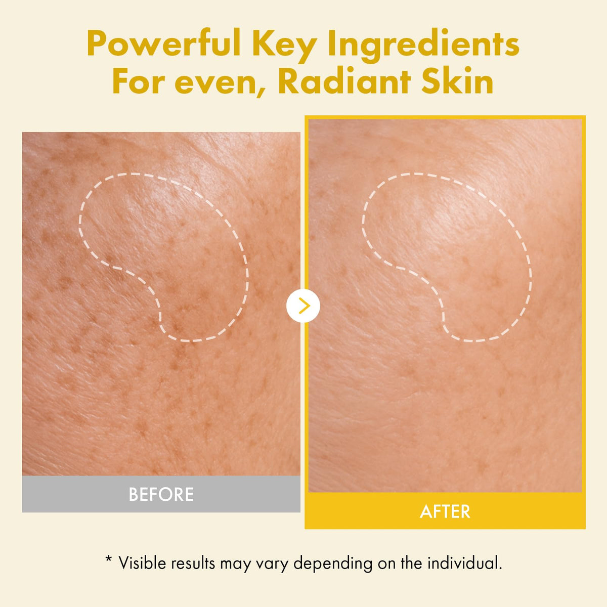 TOSOWOONG cream texture close-up highlighting smooth spreadability and hydration