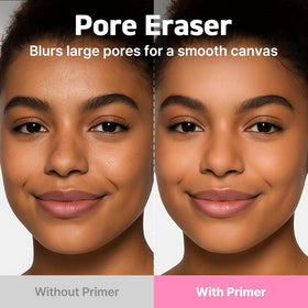 TOUCH IN SOL before and after skin comparison showing reduced pore visibility