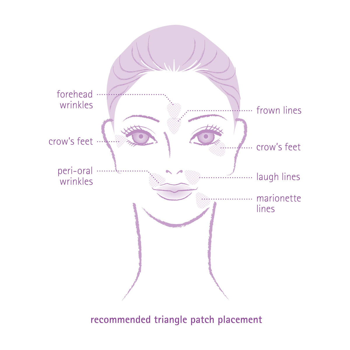 Toute Nuit patch on outer eye area reducing crow's feet movement, subtle look benefit