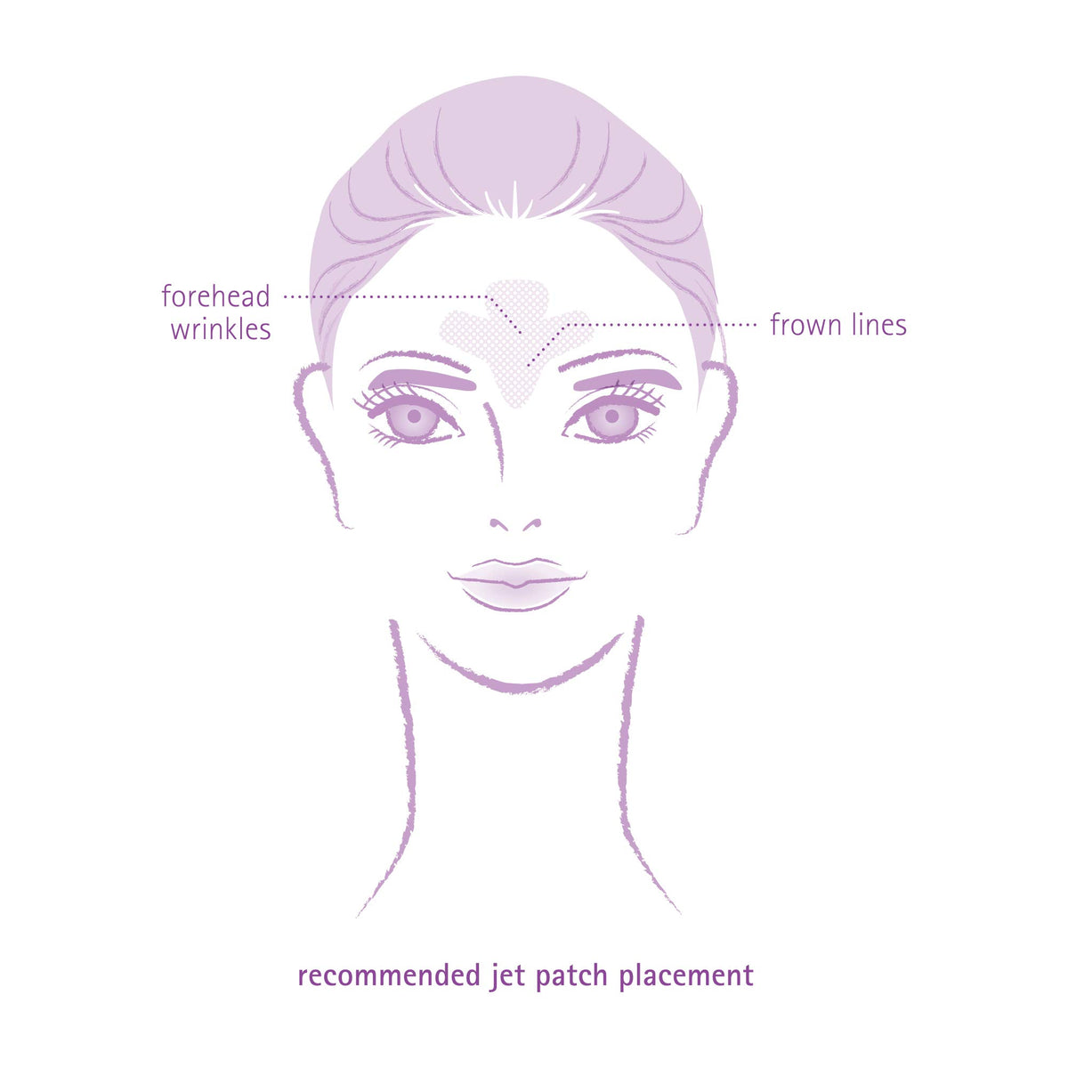 Toute Nuit patch applied between brows reducing frown movement