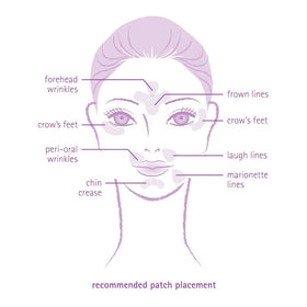 Toute Nuit triangle patch detail for targeted frown line coverage and precision