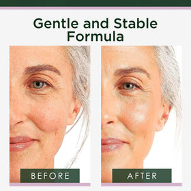 Tree of Life serum texture on skin closeup demonstrating fast absorption