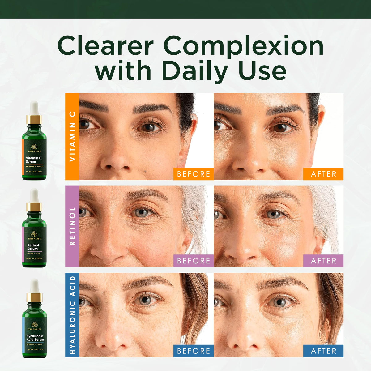 Tree of Life trio arranged on vanity conveying a cohesive skincare routine