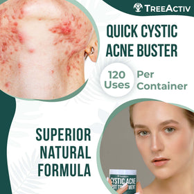 TreeActiv paste applied to chin demonstrating precise spot application