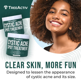 TreeActiv close-up of bentonite clay texture for oil-absorbing benefit