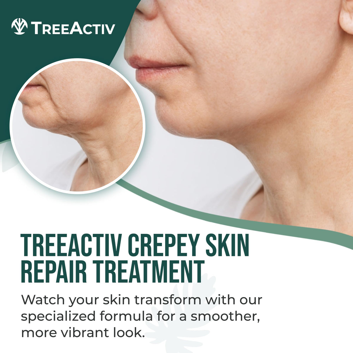 TreeActiv cream texture close-up highlighting smooth, rich consistency