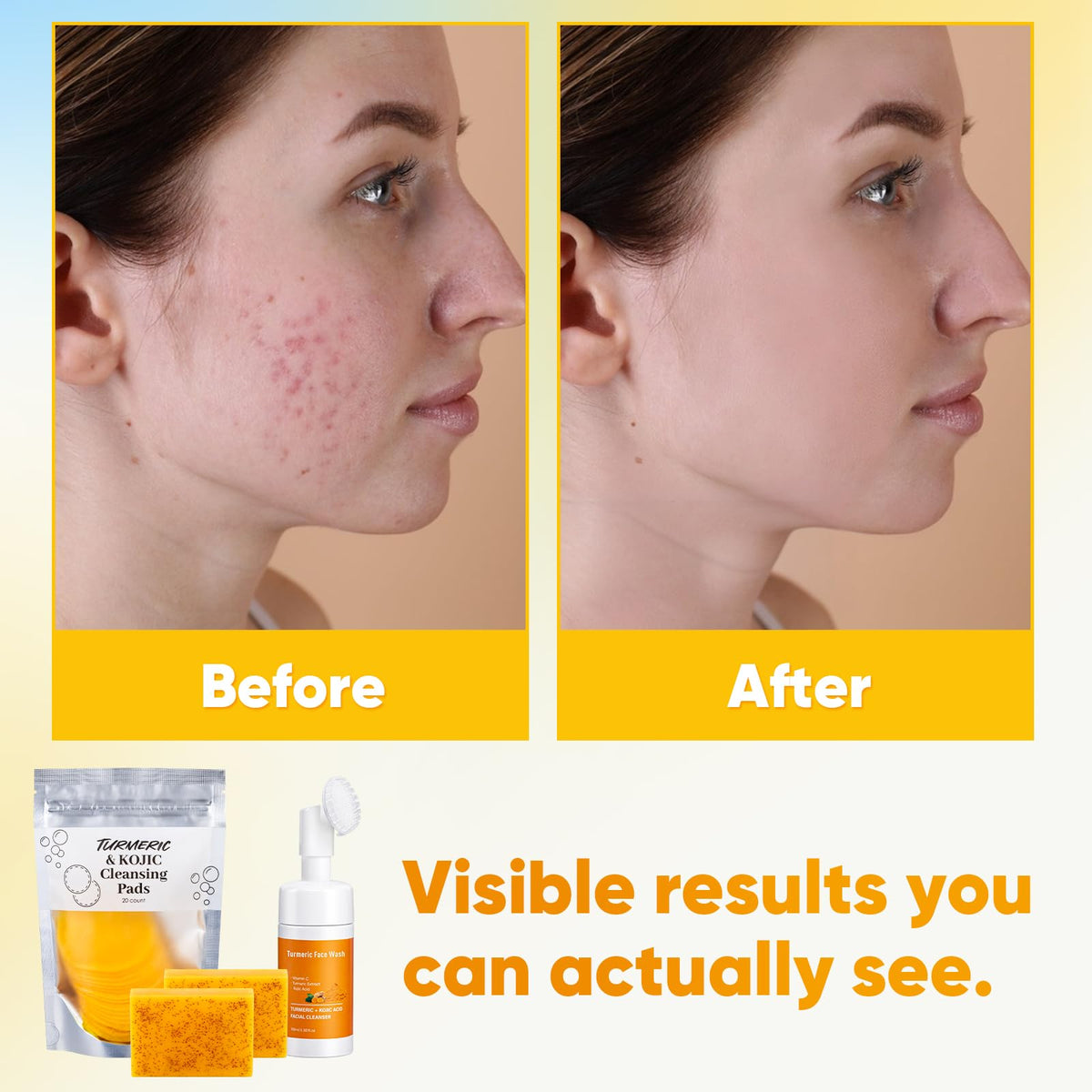 Treeroot cleansing brush in hand demonstrating even mousse distribution
