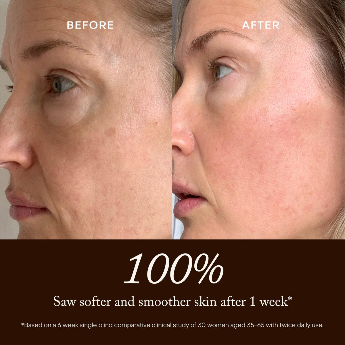 True Botanicals hyaluronic acid gel texture drop illustrating hydrating feel
