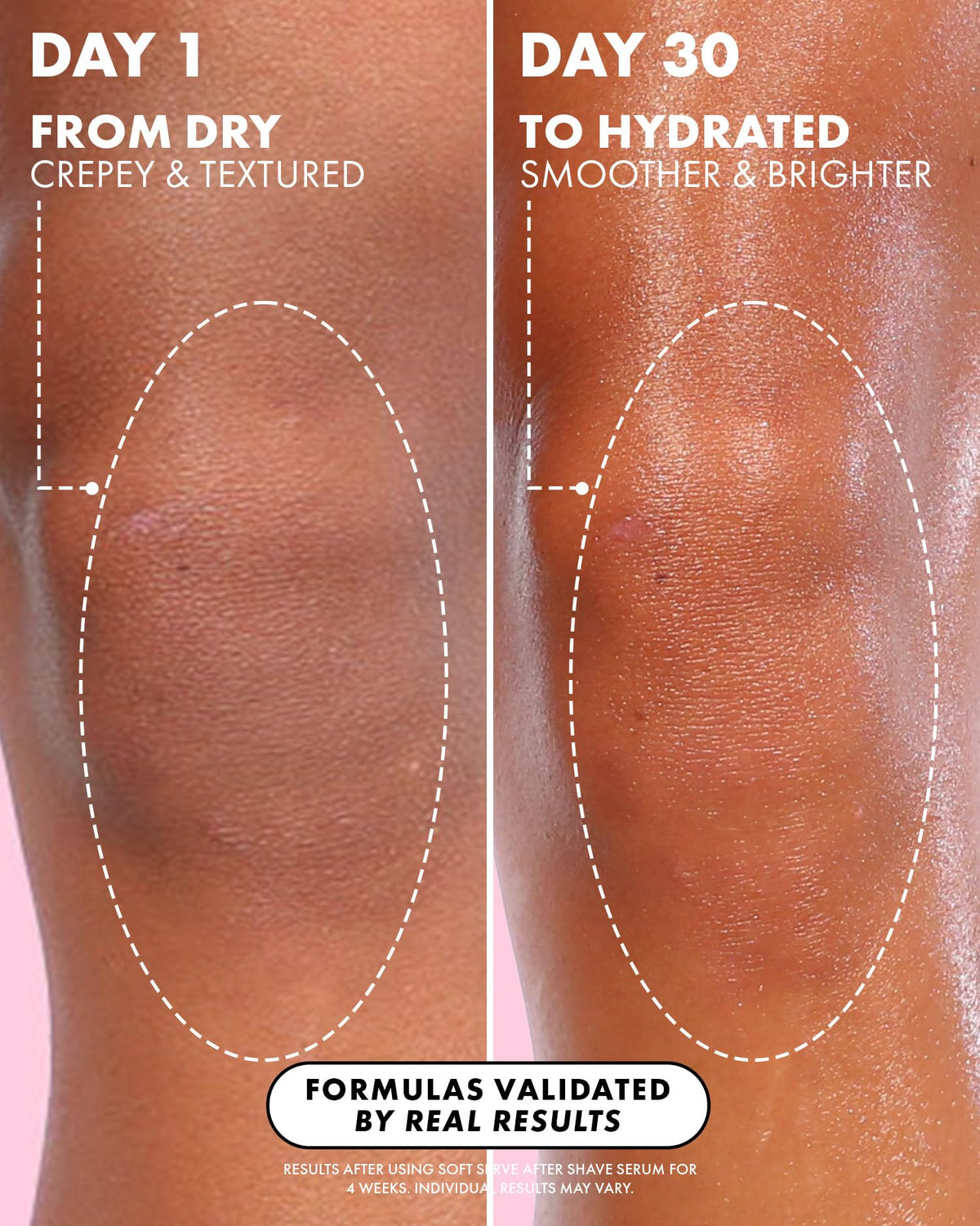 Truly on leg showing smoother skin after shave and reduced bump appearance benefit