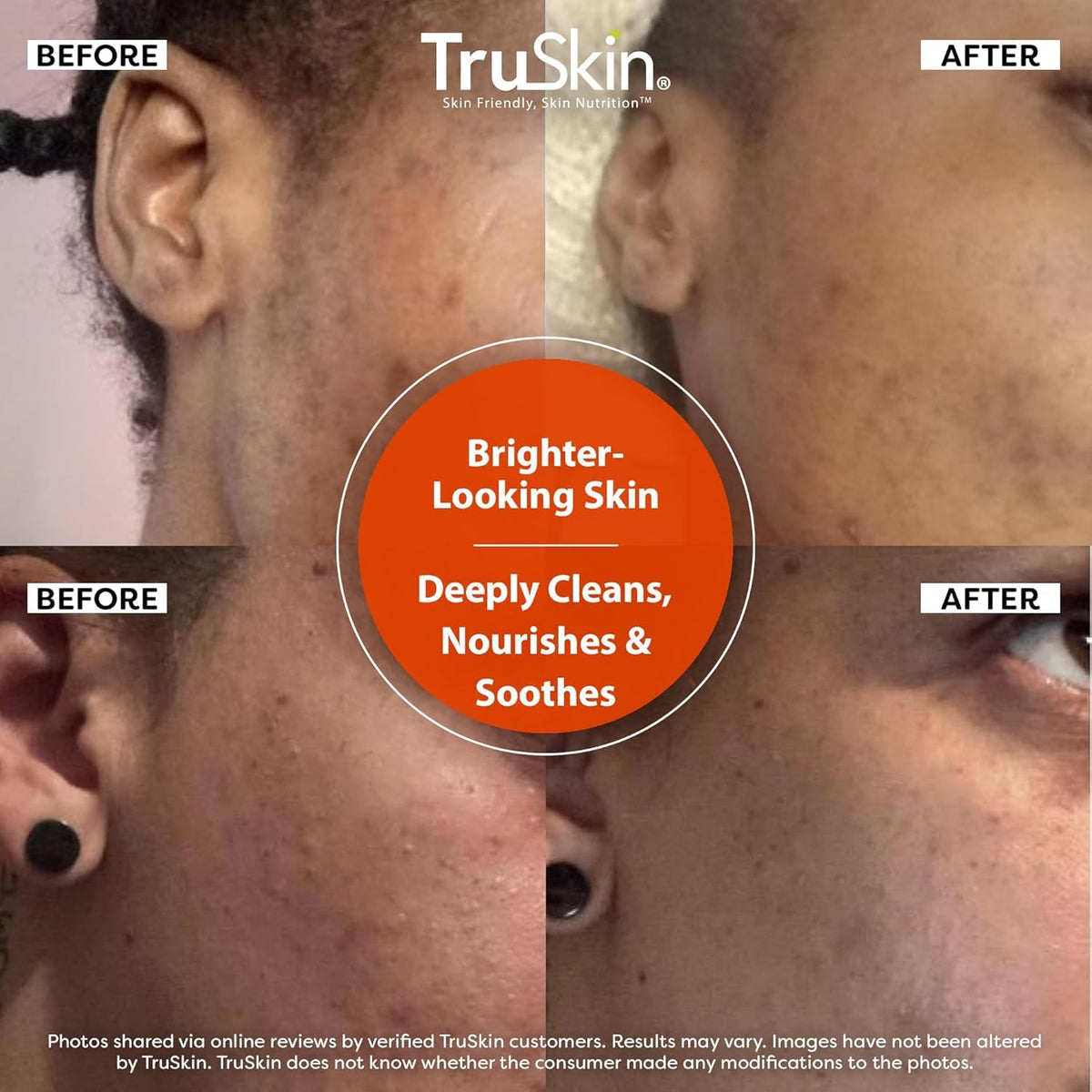 TruSkin paired with serum and moisturizer for layered skincare routine