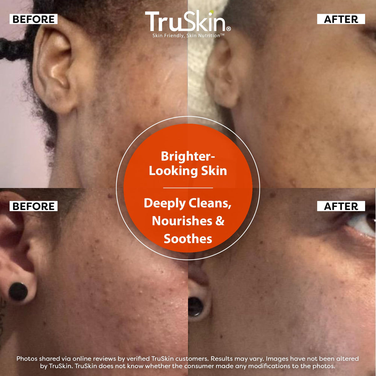 TruSkin bottle in hand to show 5 fl oz size and portability benefit