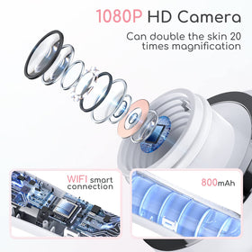 TTozka close-up of 1080P camera and LED lights improving pore visibility