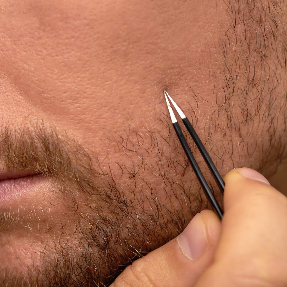 Tweezerman in use on finger demonstrating controlled removal and reduced skin irritation