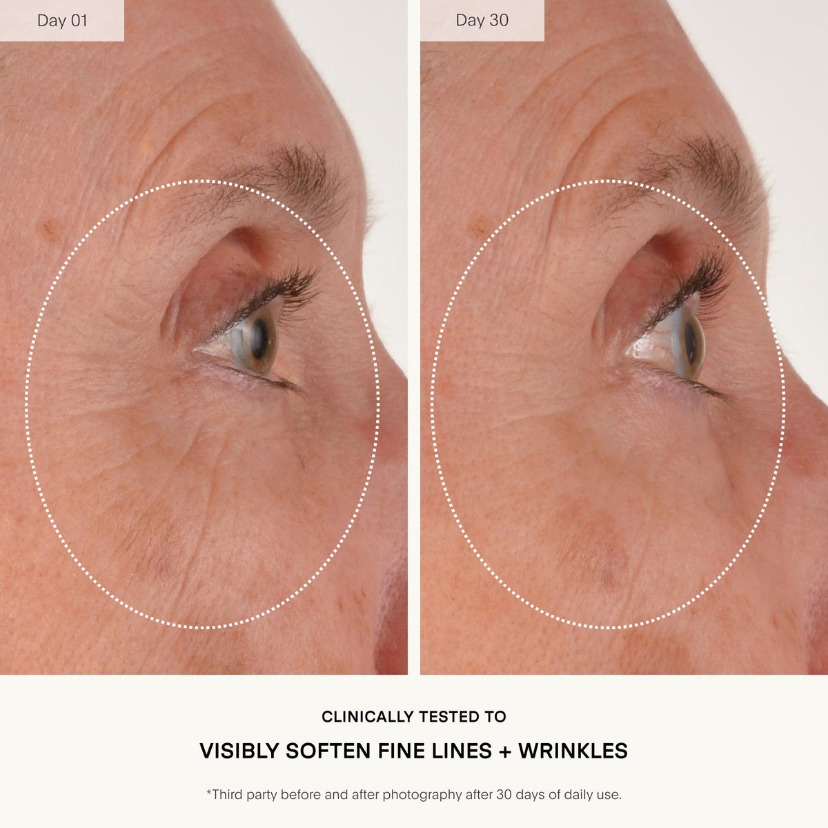 U Beauty SIREN capsule close-up highlighting targeted active delivery benefit
