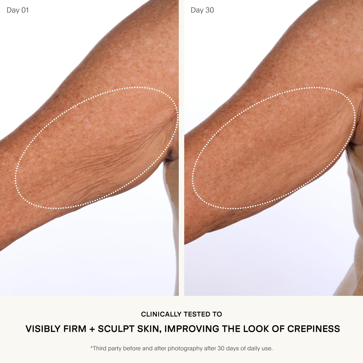 U Beauty SCULPT being applied to an arm, demonstrating targeted firming and smoothing