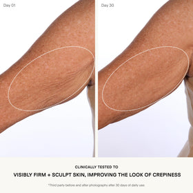 U Beauty SCULPT being applied to an arm, demonstrating targeted firming and smoothing