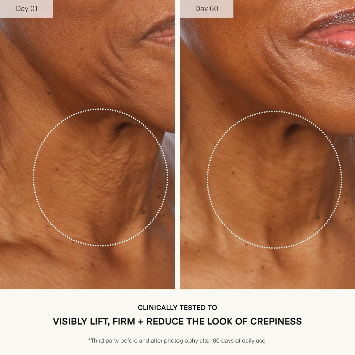 U Beauty being applied to neck with upward strokes to promote lifting benefit