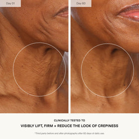 U Beauty being applied to neck with upward strokes to promote lifting benefit