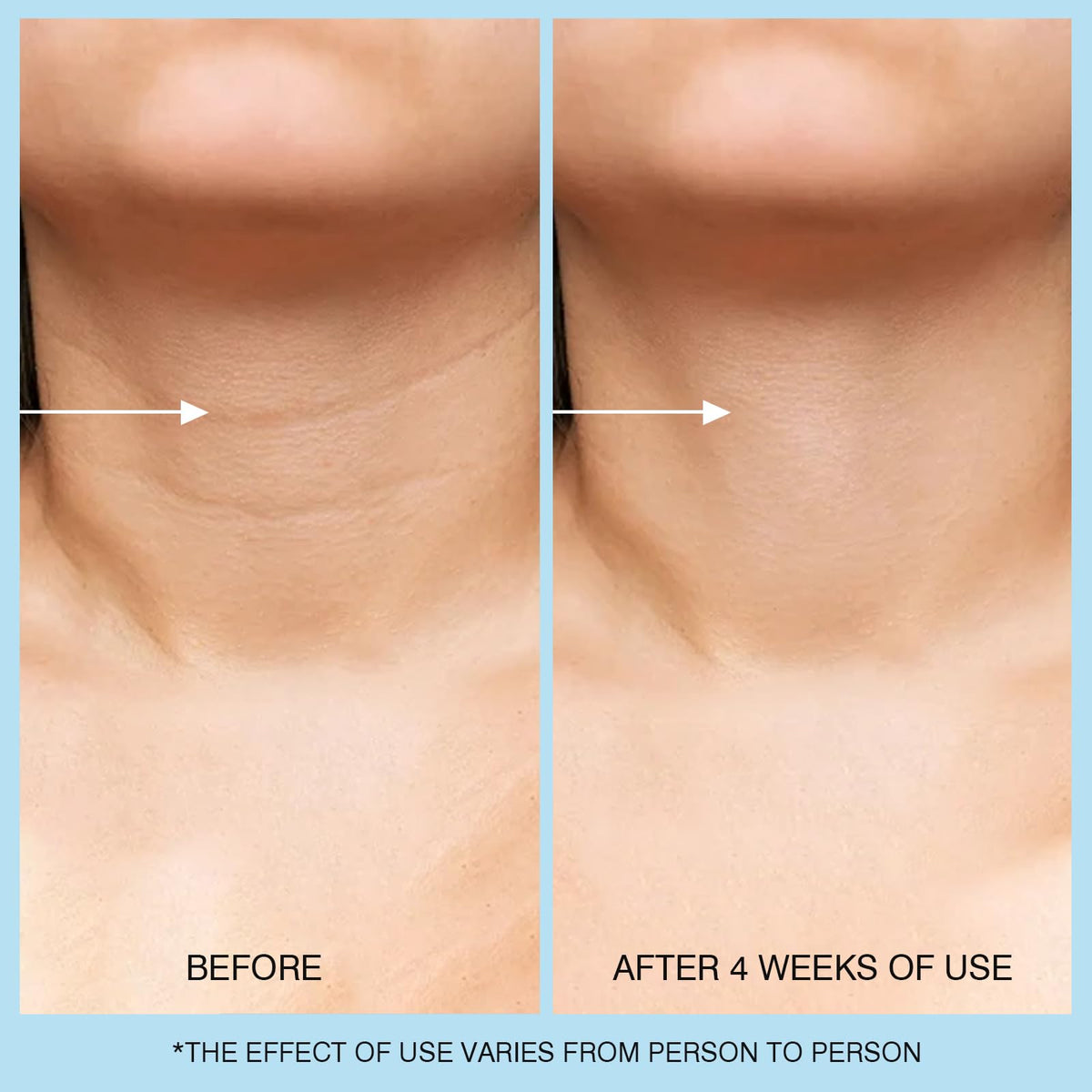 UJhay ingredient label showing retinol and hyaluronic acid benefits