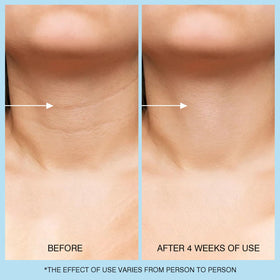 UJhay ingredient label showing retinol and hyaluronic acid benefits