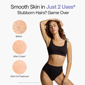 Ulike Air 10 handheld in use on leg, demonstrating quick, at‑home hair reduction