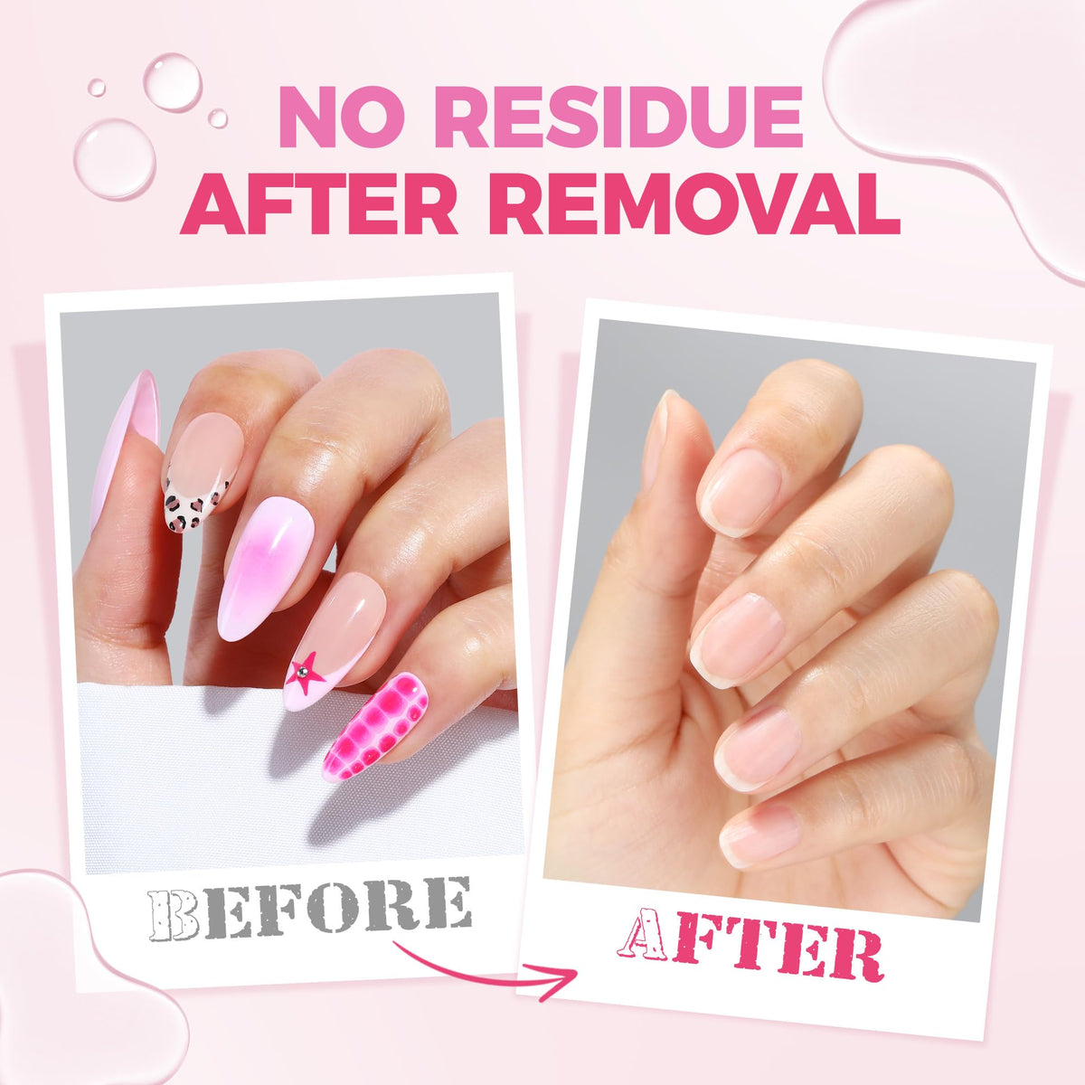 UNA GELLA applicator tip closeup demonstrating precision for targeted removal