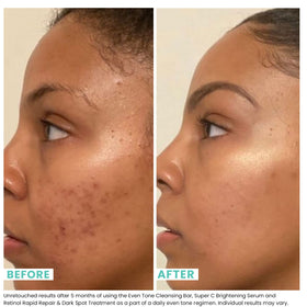 Urban Skin Rx bar producing creamy lather to gently exfoliate skin