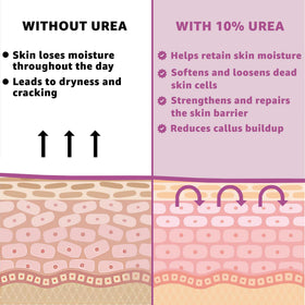 UREA LABS jar on bedside table suggesting nightly repair routine and comfort benefit