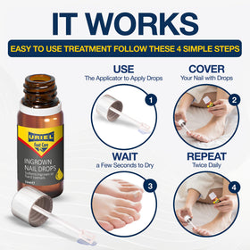 URIEL being applied to toe to show safe at-home use and reduced discomfort