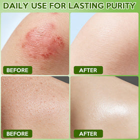 Urrznp coconut and olive oils close-up showing moisturizing benefits