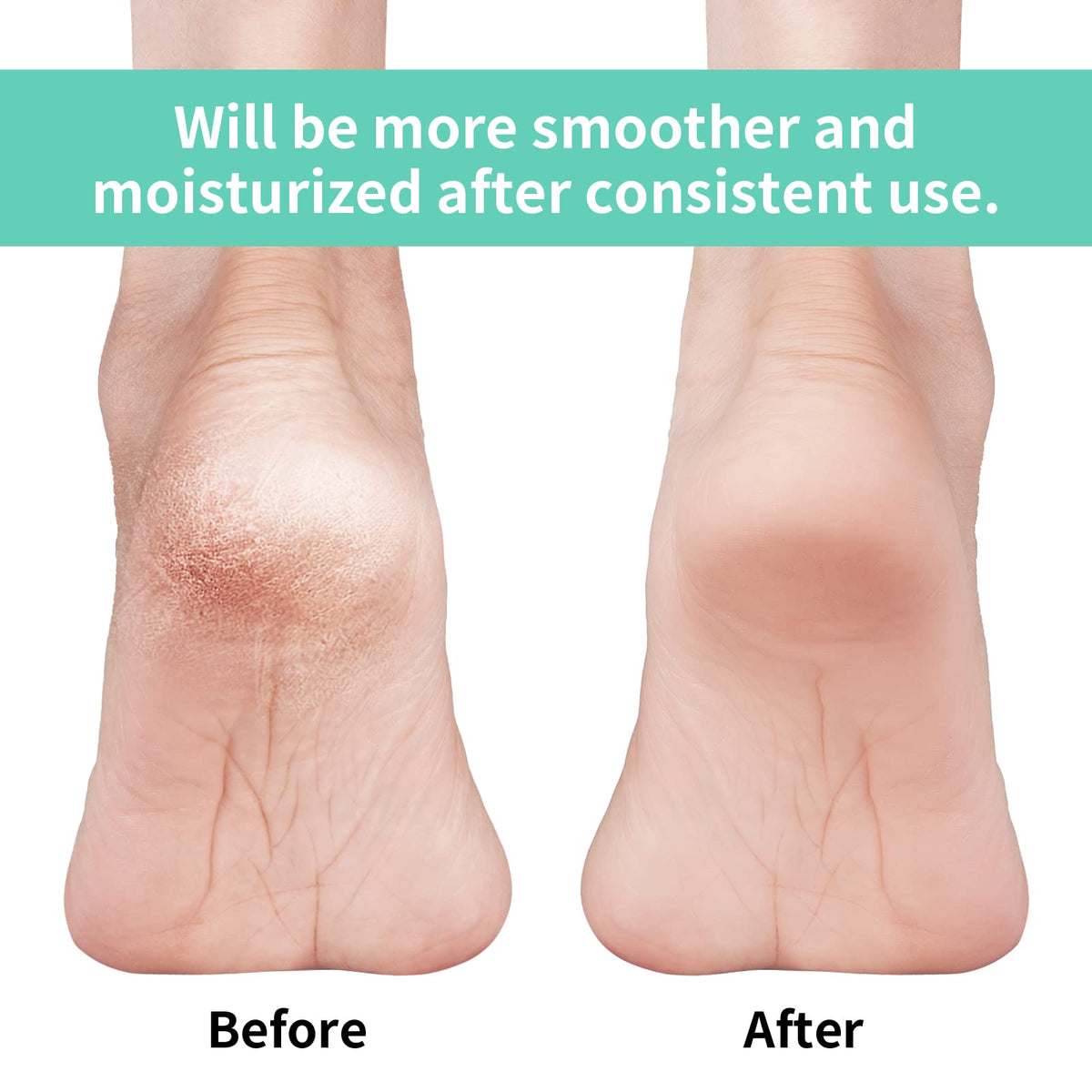 Vaincre gel close-up revealing silicone-lined heel that locks in moisture for repair