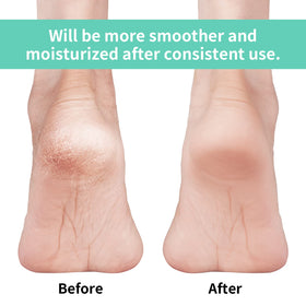 Vaincre gel close-up revealing silicone-lined heel that locks in moisture for repair