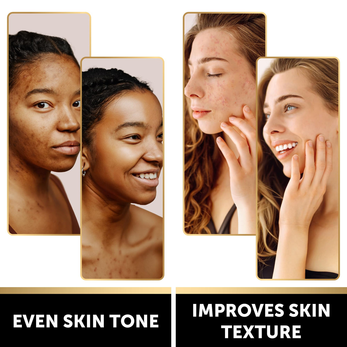 VALITIC turmeric bar close-up texture highlighting brightening benefit