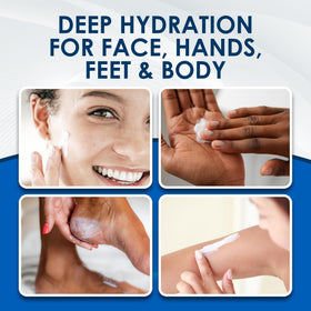 Using Vanicream on elbows and feet for intensive hydration and repair
