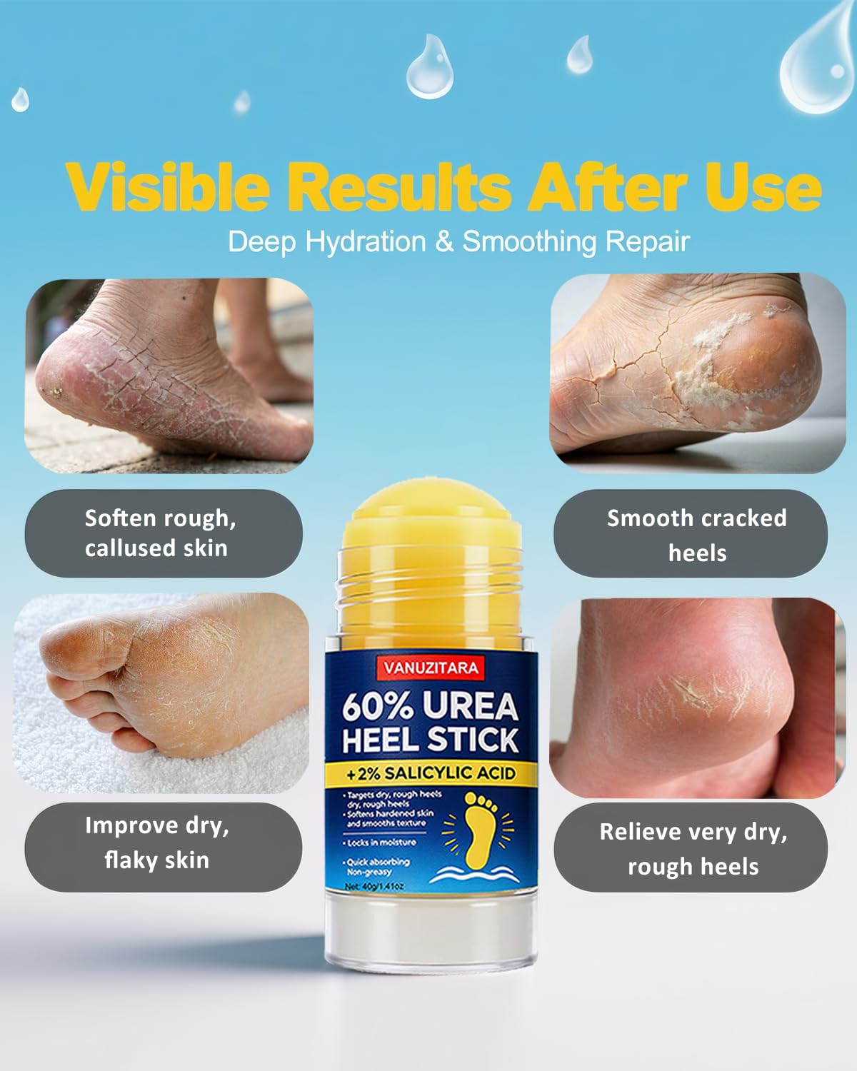 VANUZITARA applying stick to heel for targeted softening