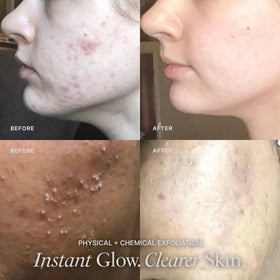 VASANTI papaya ingredient focus emphasizing natural enzyme brightening benefit