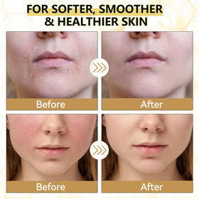 Veakoo fingertip dollop of balm demonstrating easy melt-on-contact application for targeted care