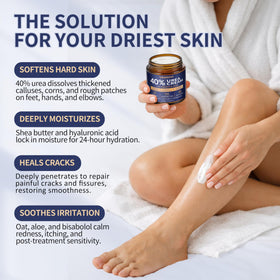 Veakoo urea cream being applied to a heel to soften calluses and hydrate