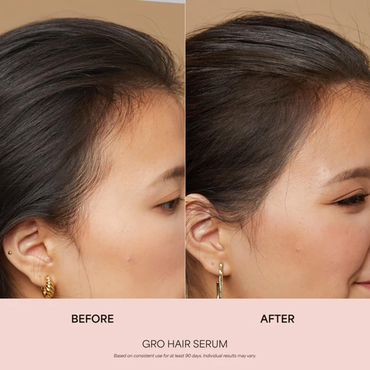 VEGAMOUR GRO applying serum to scalp demonstrating easy daily use benefit