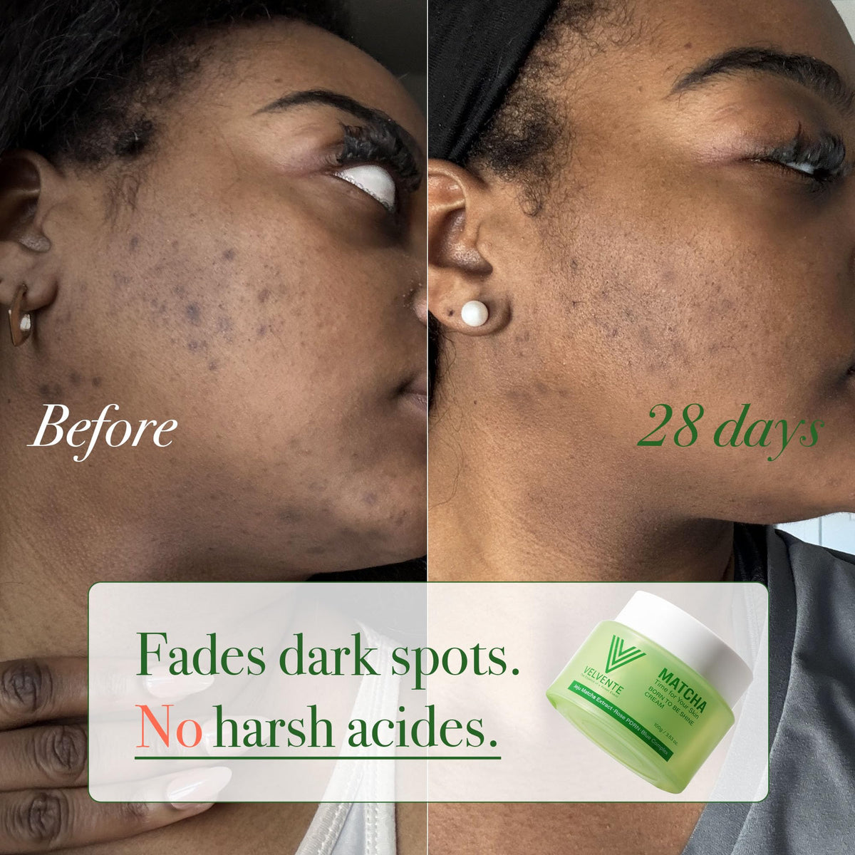 VELVENTE used as overnight mask on skin for deep nourishment and recovery