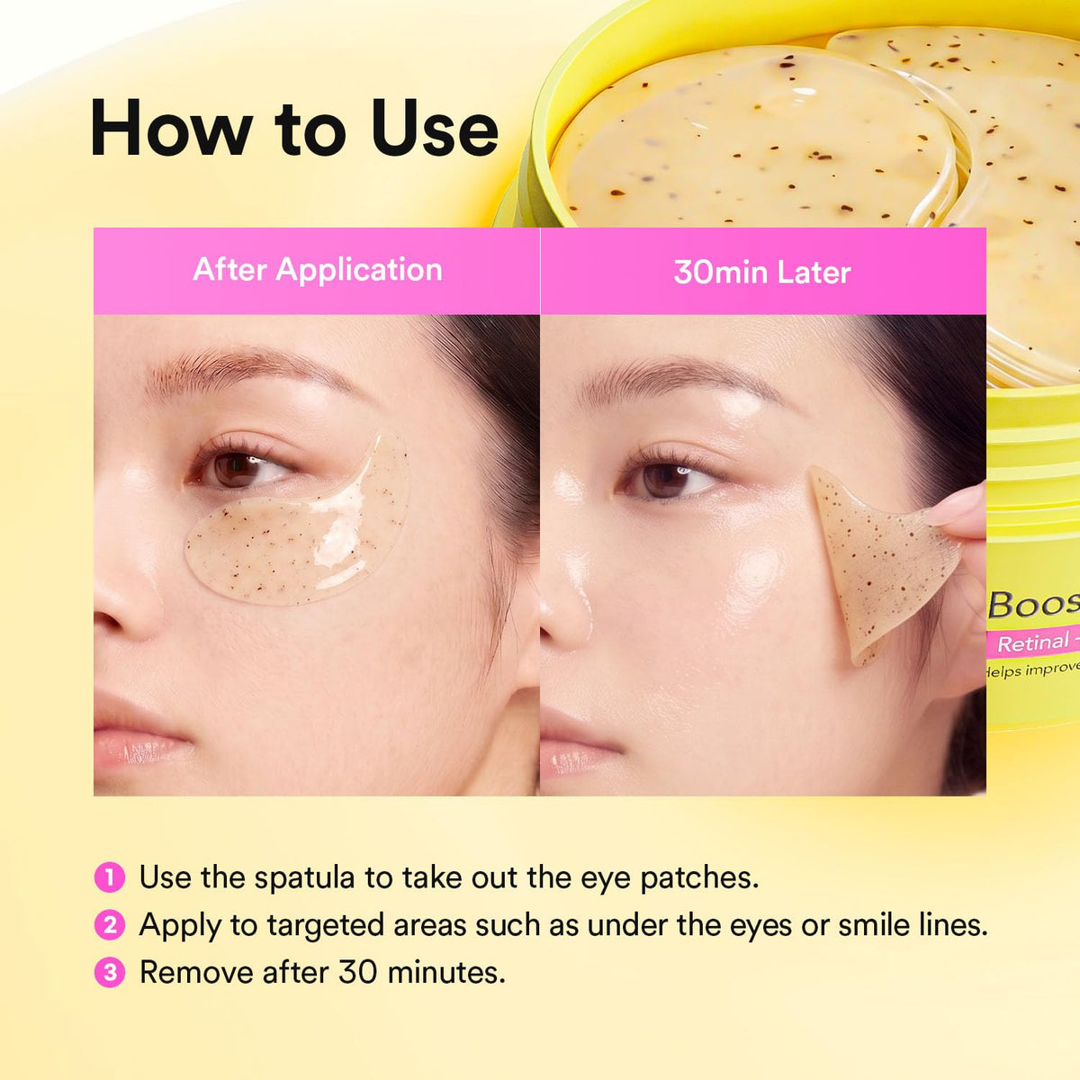 VERAFECT schematic before-and-after concept showing reduced lines and puffiness