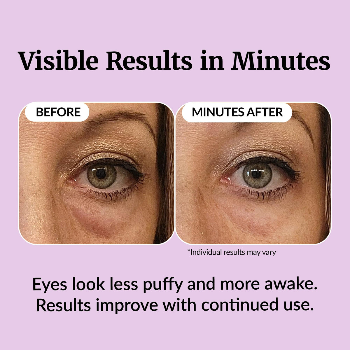 Vibriance before and after illustration demonstrating reduced puffiness