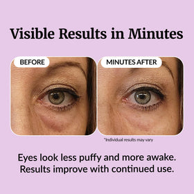 Vibriance before and after illustration demonstrating reduced puffiness