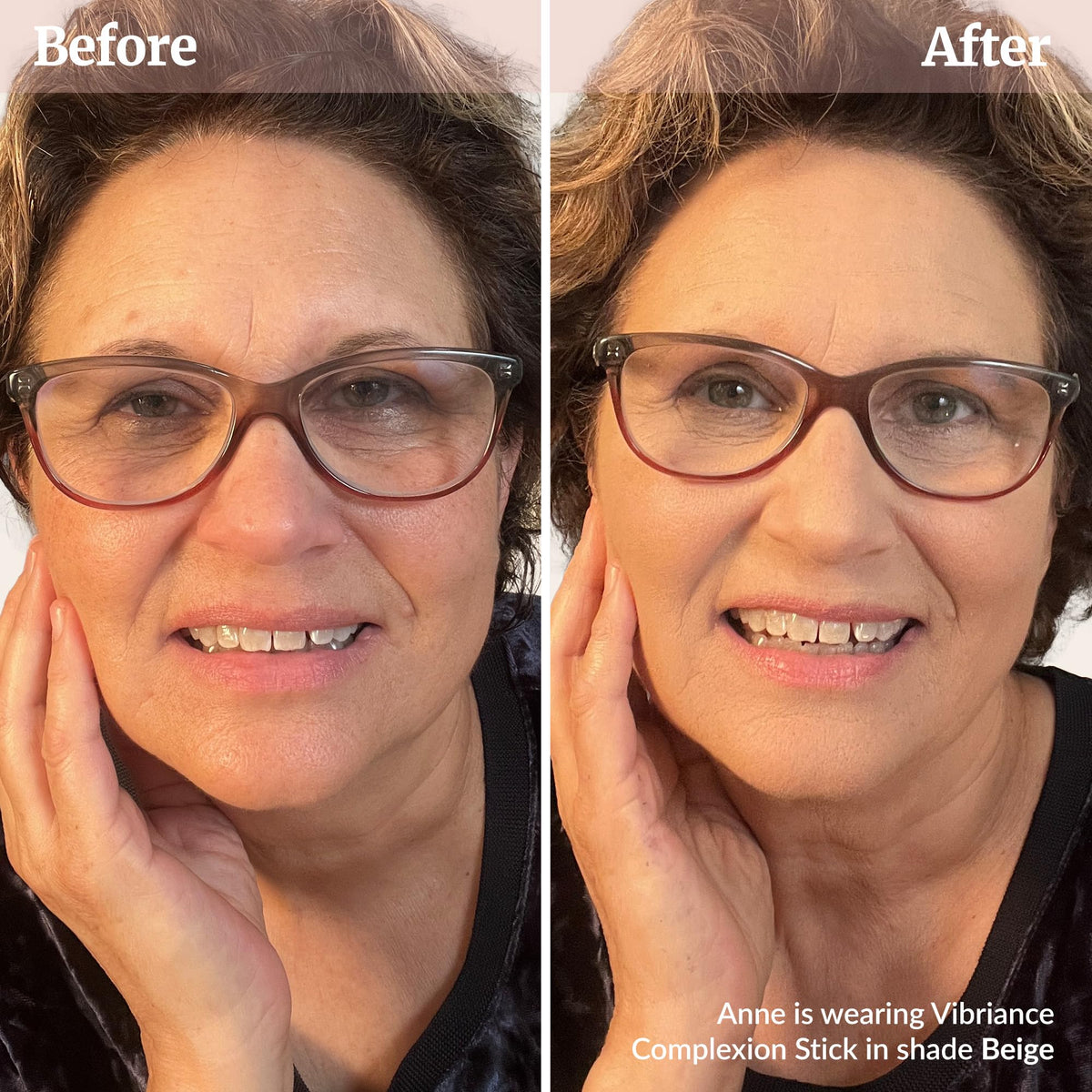 Vibriance applied under eye with finger illustrating brightening and smoothing benefit