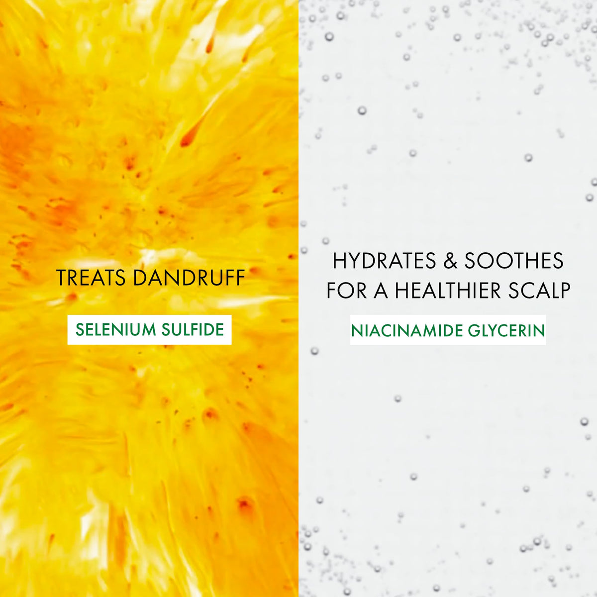 VICHY Dercos label close-up highlighting active 0.6% selenium sulfide and benefits