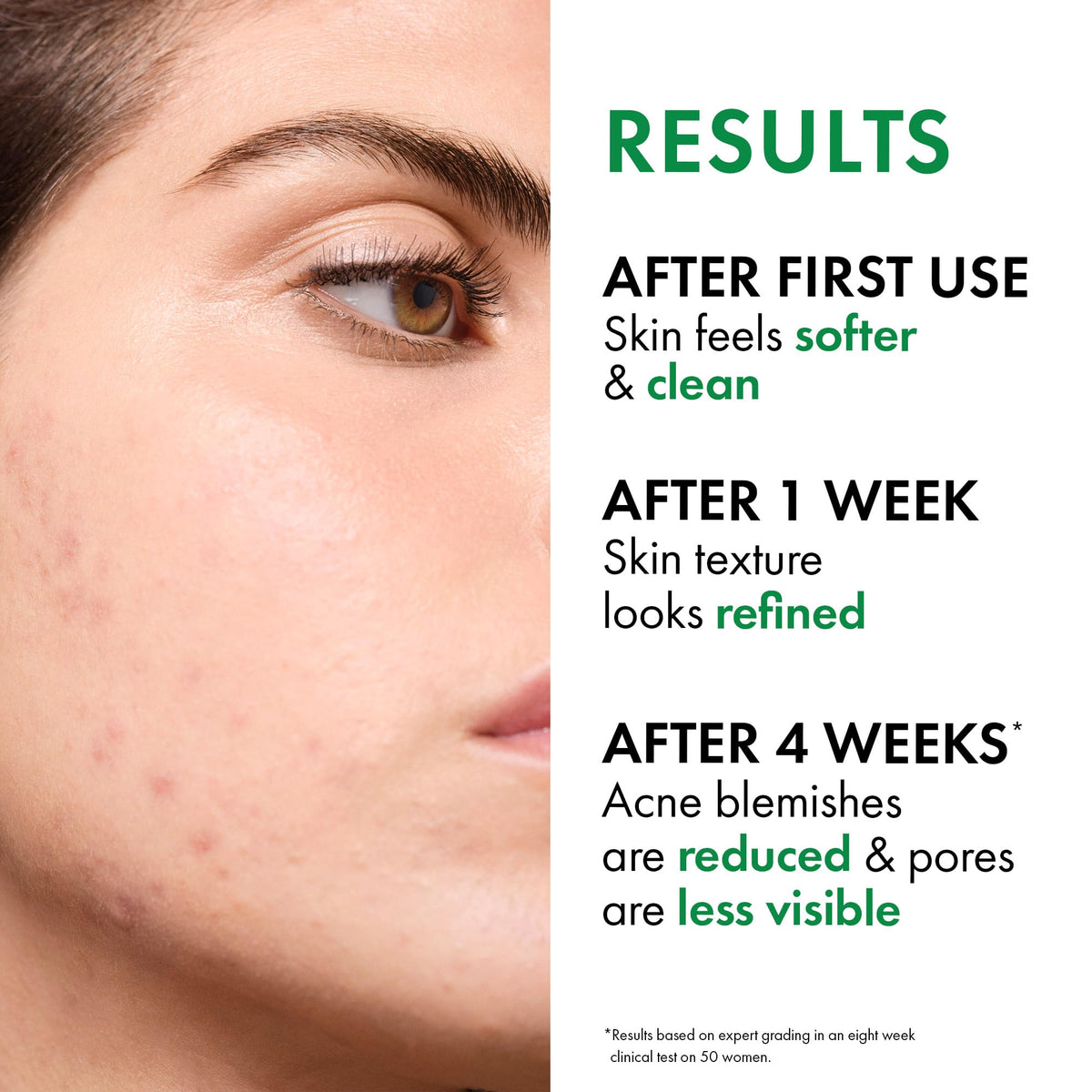 VICHY Normaderm with salicylic acid visual emphasizing exfoliation benefits