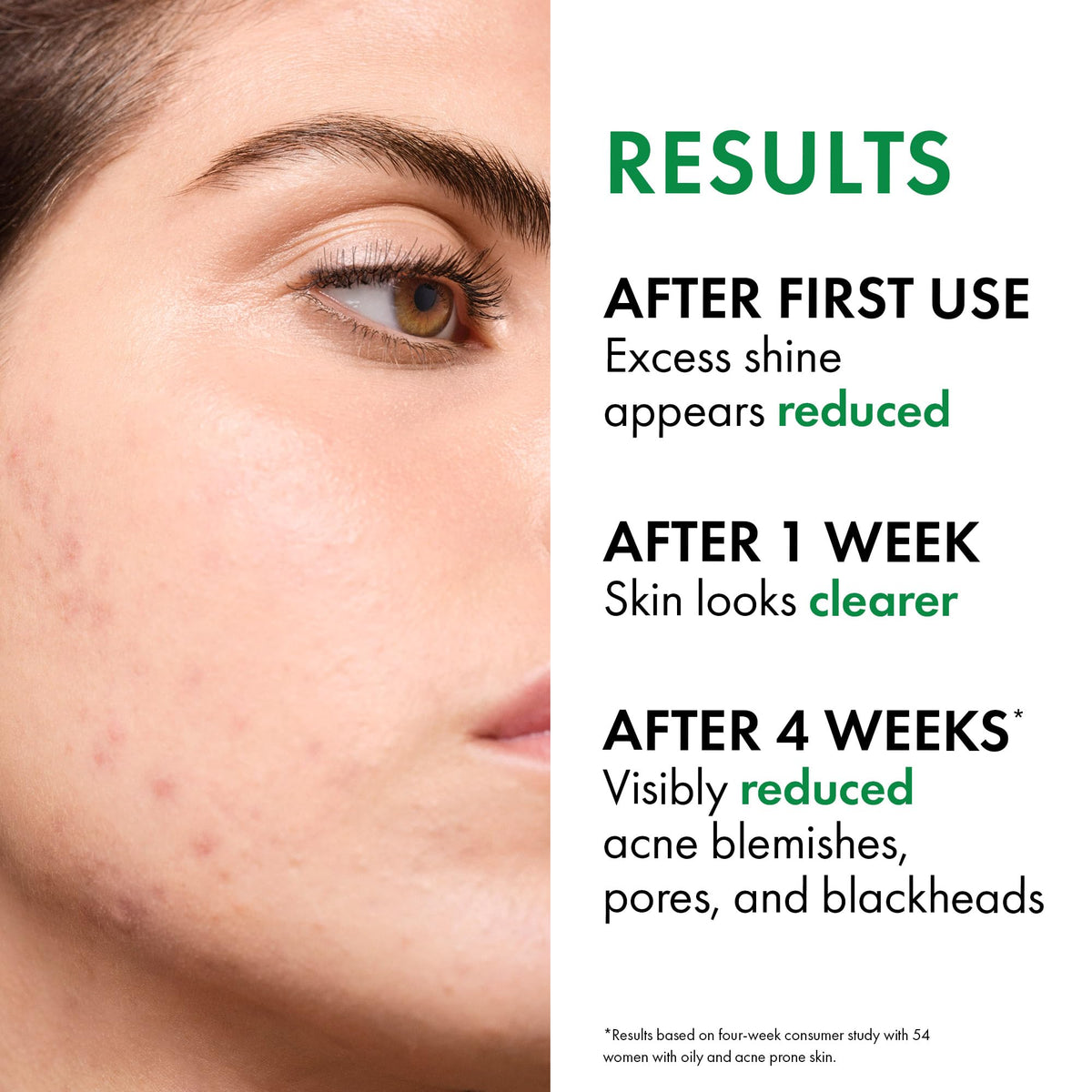 VICHY Normaderm pump dispense detail for controlled, mess-free application